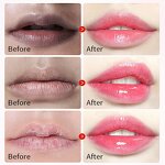 Lip Mask Manufacturer - Crystal Patch for Whitening 24K Gold Pink Hydrogel Collagen Private Label MOOYAM