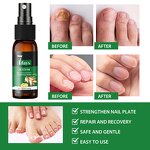 Nail Treatment Spray Manufacturer - 7 Days Nail Fungus for Bacteria Repair 30ml Customized OEM MOOYAM