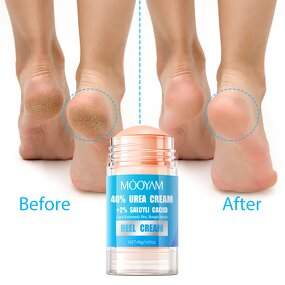 Foot Cream Manufacturer - 40% Urea+2% Salicylic Acid for Dry Rough Skin Nourishing OEM MOOYAM