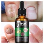 Nail Treatment Serum Manufacturer - 7 Days Nail Fungus for Damage Repair 30ml New Design MOOYAM