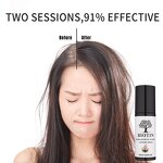Hair Loss Prevention Spray Manufacturer - Best Selling Biotin 100ml - Plant Essence Hair Treatment, Deep Activation for Growth