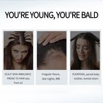 Hair Growth Spray Manufacturer - New Biotin 100ml - Organic Toner Lotion Serum for Dry Hair, OEM/ODM, Wholesale