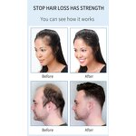 Hair Tonic Lotion Manufacturer - Organic Chinese - Rosemary Oil Essence Serum, Nourishing, Helps Grow Bald Hair Fast