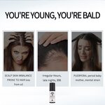 Anti-hair Loss Spray Manufacturer - Fast Growth Biotin 100ml - Ginger Rosemary Extract, Strengthening Anti-baldness Care, Unisex