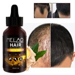 Hair Oil Manufacturer - MELAO Private Label Organic Hair Growth Serum Natural Black Hair Formula