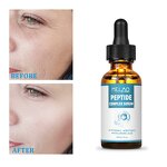 Face Serum Manufacturer - Retinol Facial Serum Women Anti-Aging Skin Renewing Retinol All Skin Types