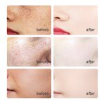 Face Serum Manufacturer - Anti-Aging Lift Brightening Hyaluronic Acid Vitamin C E Glycyrrhiza Glabra