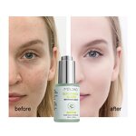 Face Serum Manufacturer - Anti-Aging Lift Brightening Hyaluronic Acid Vitamin C E Glycyrrhiza Glabra