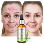 Face Serum Manufacturer - Custom Natural Dark Spot Whitening Anti-Aging Collagen Corrector Serum