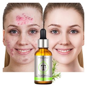 Face Serum Manufacturer - Custom Natural Dark Spot Whitening Anti-Aging Collagen Corrector Serum