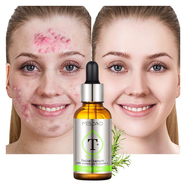 Face Serum Manufacturer - Custom Natural Dark Spot Whitening Anti-Aging Collagen Corrector Serum