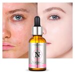 Face Serum Manufacturer - MELAO Anti-Redness Brightening Tea Tree Oil Dry Skin Moisturizing Formula