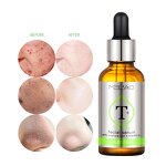 Face Serum Manufacturer - Custom Natural Dark Spot Whitening Anti-Aging Collagen Corrector Serum
