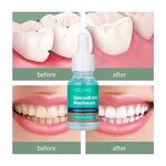 Mouthwash Manufacturer - Dental Care Kit Vitamin E Dental Whitener Oral Care Hotel Amenities 300ml