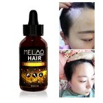 Hair Oil Manufacturer - MELAO Private Label Organic Hair Growth Serum Natural Black Hair Formula