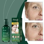 Hyaluronic Acid Essence Manufacturer - Snail Hyaluronic Acid Female Face Skin Care Treatments