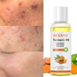 Turmeric Essential Oil Manufacturer - Acne Treatment Organic Skin Care Facial Serum Whitening Face Oils Pure Natural