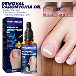 Nail Relief Oil Manufacturer - Wholesale WEST MONTH Nail Care Fast Effective Removal Anti Paronychia Relief 10ml