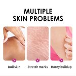 Peeling Oil Manufacturer - Private Label Extra Strong Peeling Oil Scar Remove Stretch Marks Whitening Yellow