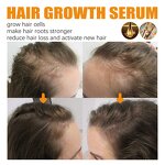 Hair Growth Serum Manufacturer - EELHOE Anti Hair Loss Treatment Ginger Oil Regrowth Care Biotin Men Women