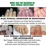 Nail Removal Gel Manufacturer - Jaysuing 7DAYS Repair Nail Treatments Essence Foot Care Toe Nails Fungal Anti-Infection