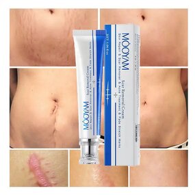 Scar Removal Cream Manufacturer - Fastest Acne Scar Face Care Scar Gel Bruise Repair Tummy Tuck 30g Stretch Mark