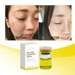 Melasma Whitening Essence Manufacturer - Moisturizing Hydrating Light Line Anti-Wrinkle Anti-Aging