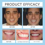 Dental Kit Manufacturer - Hot Sale Oralhoe Silicone Dentures Braces Retouching Filling Cosmetic Dental Kit False Teeth