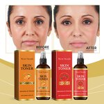 Rose Skin Toner Manufacturer - Rose Extract Toner Spray