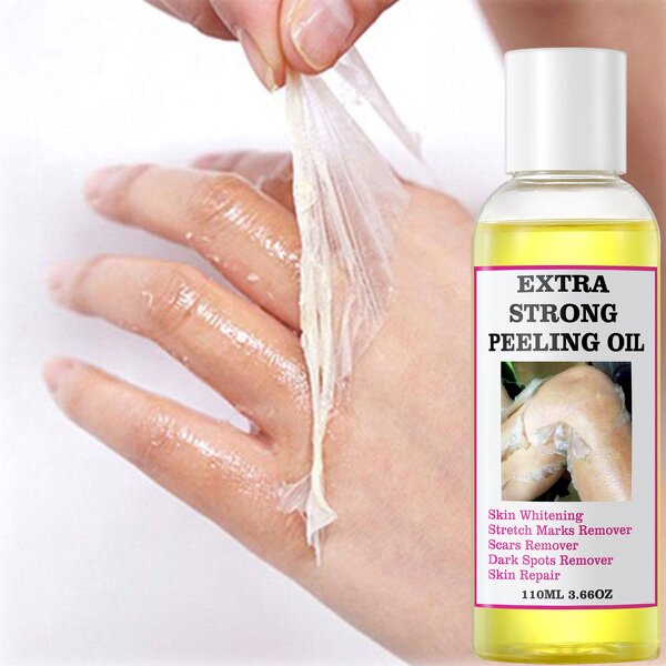Peeling Oil Manufacturer - Wholesale Powerful Yellow Knuckle Skin Whitening Moisturizing Remove Dead Skin Exfoliating