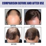 Hair Growth Foam Manufacturer - East Moon Men Deep Repair Hair Root Follicle Promotes Fast Growing Castor Argan Oil