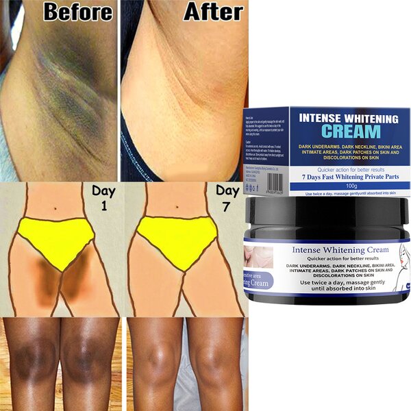 Private Parts Whitening Cream Manufacturer - 7 Days Fast Whitening Dark Inner Intimate Brightening Vegan OEM Guangdong