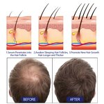 Hair Growth Foam Manufacturer - East Moon Men Deep Repair Hair Root Follicle Promotes Fast Growing Castor Argan Oil