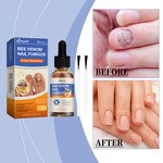 Nail Treatment Solution Manufacturer - Hot Selling Custom Private Label Soft Nail Thick Nail Antibacterial