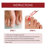 Nail Renewal Liquid Manufacturer - Nail Renewal Extra Strength Fungus Toe Fingernails Repair Damaged Broken 7 Days