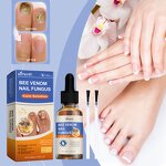 Nail Treatment Solution Manufacturer - Hot Selling Custom Private Label Soft Nail Thick Nail Antibacterial