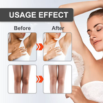 Private Parts Whitening Lotion Manufacturer - Snow Bleach Private Part Underarm 30ml Liquid Adults Female OEM/ODM