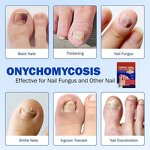 Nail Patches Manufacturer - Best Anti Fungal Nail Treatment Stickers Private Label OEM 8 Hours Overnight Repair