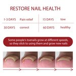 Nail Repair Liquid Manufacturer - Wholesale Fungal Nail Renewal Extra Strength Toe Fingernails Repair Damaged Broken