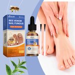 Nail Treatment Solution Manufacturer - Hot Selling Custom Private Label Soft Nail Thick Nail Antibacterial