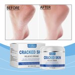 Skin Relieve Cream Manufacturer - OCEAURA Cracked Skin Relieve Foot Elbow Care Cosmetic Brand New