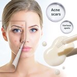 Brightening Essence Manufacturer - Eliminate Various Spot Acne Treatment Moisturizing Skin Anti Wrinkle