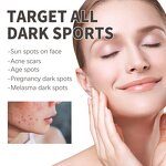 Brightening Essence Manufacturer - Eliminate Various Spot Acne Treatment Moisturizing Skin Anti Wrinkle