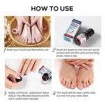 Nail Treatment Solution Manufacturer - LANTHOME 10ml Nail Repair Clean Whiten Nourish Fungal Toe Nail Treatment