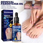 Nail Relief Oil Manufacturer - Wholesale WEST MONTH Nail Care Fast Effective Removal Anti Paronychia Relief 10ml