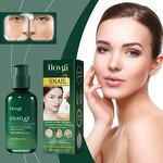 Hyaluronic Acid Essence Manufacturer - Snail Hyaluronic Acid Female Face Skin Care Treatments