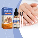 Nail Treatment Solution Manufacturer - Hot Selling Custom Private Label Soft Nail Thick Nail Antibacterial