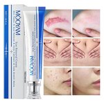 Scar Removal Cream Manufacturer - Fastest Acne Scar Face Care Scar Gel Bruise Repair Tummy Tuck 30g Stretch Mark