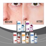 B5 Serum Manufacturer - Moisturizing Whitening Essence Liquid Anti Aging Moisturizing Bulk Face