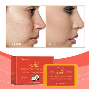 Facial Soap Manufacturer - 100% Organic Natural Plant Cleansing Control Oil Acne Nourish Skin Top Seller